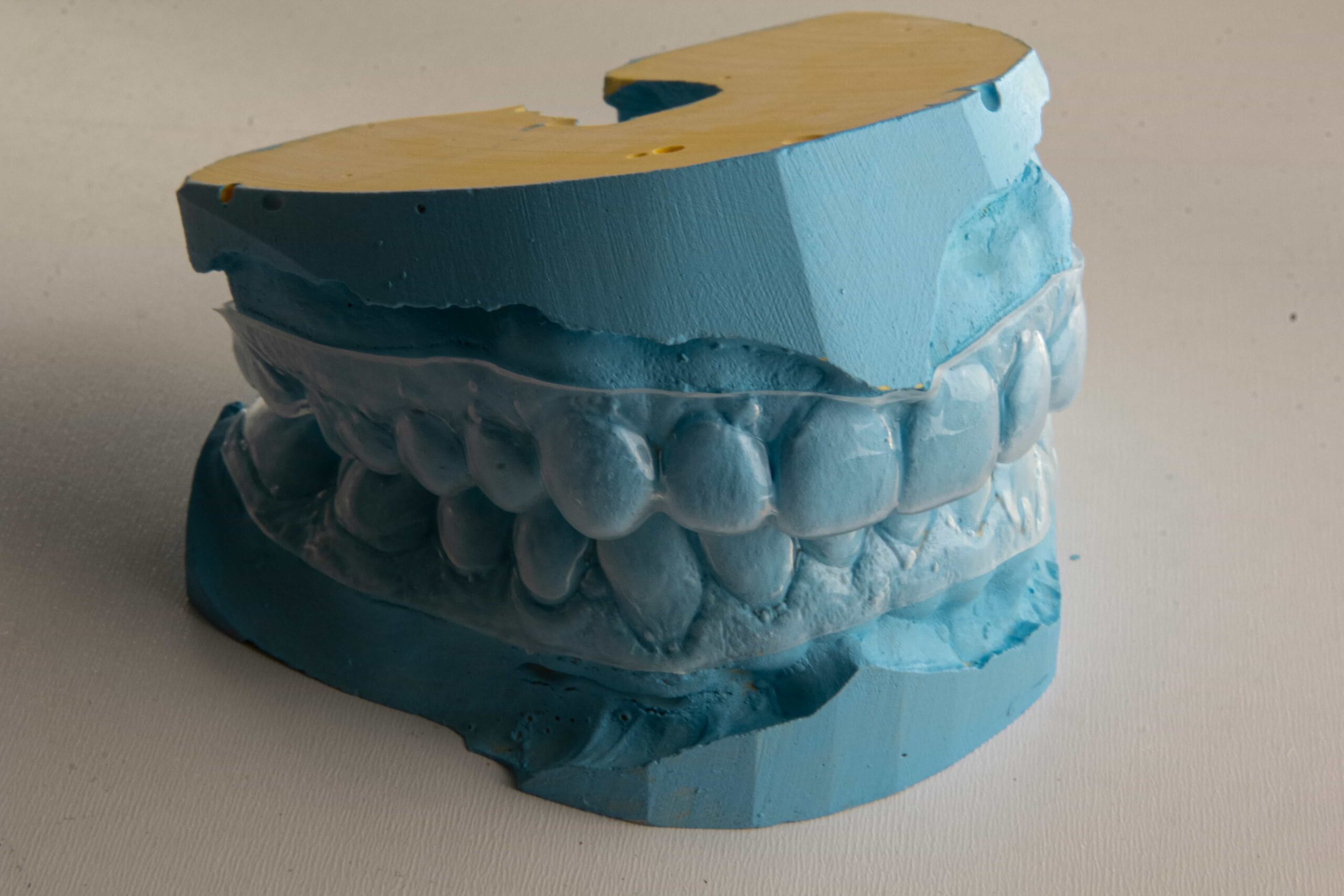 INVISALIGN ON TEETH