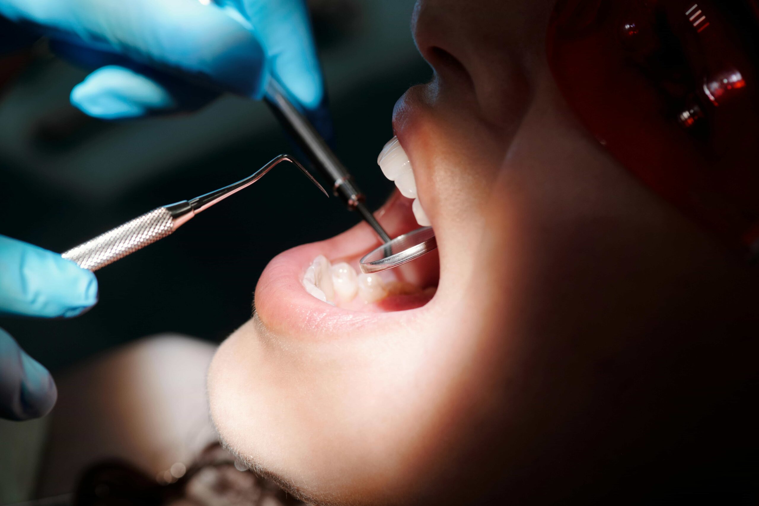 orthodontist checking teeth on patient