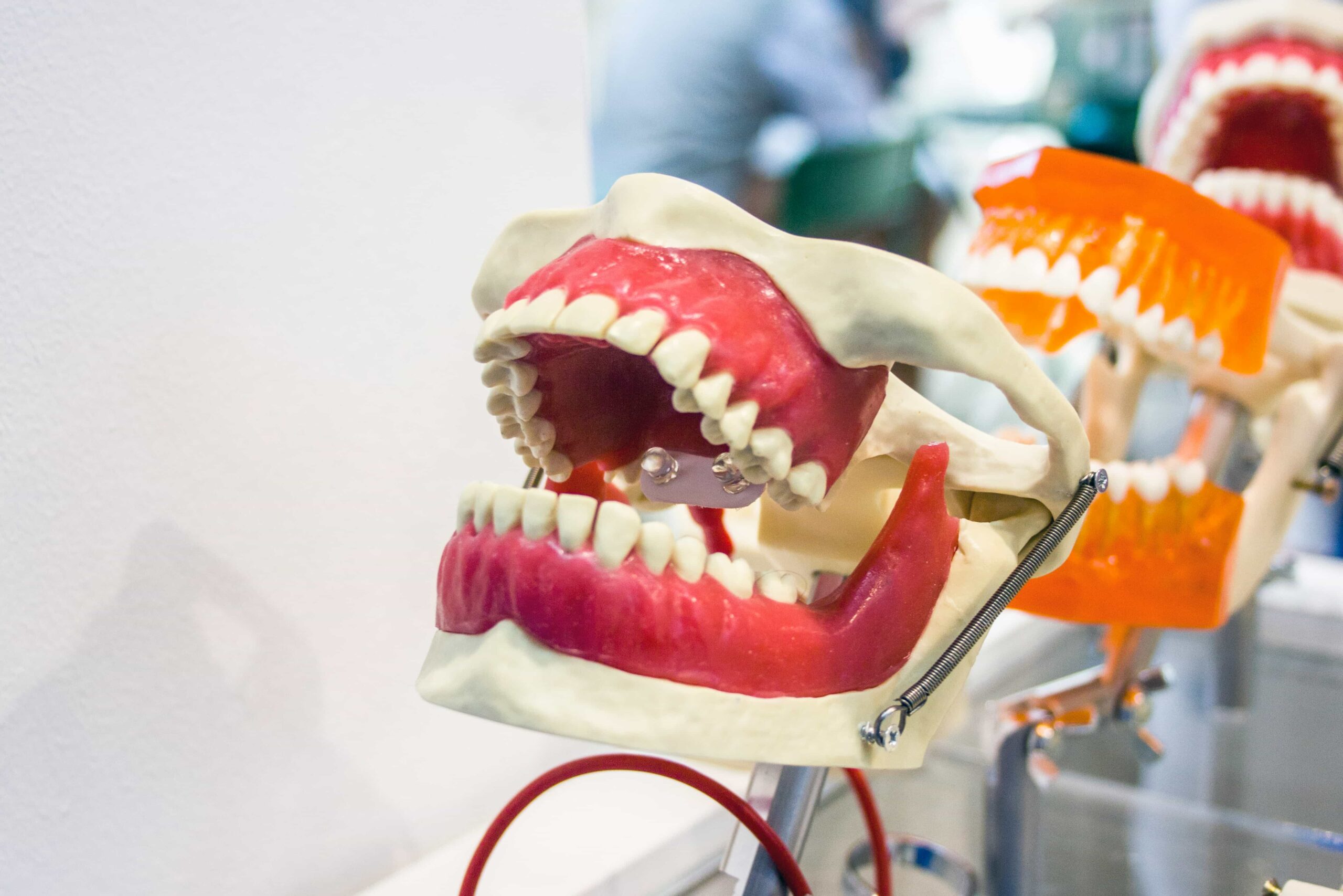 model teeth in orthodontic office